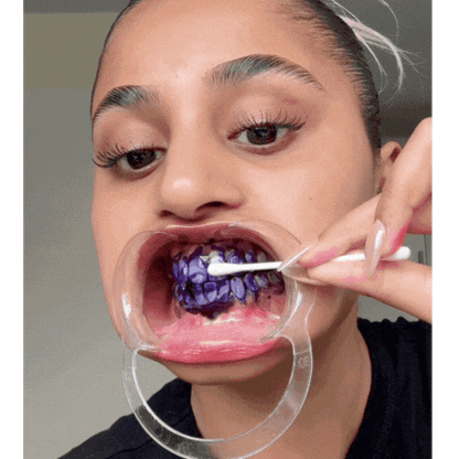 Blanqueador Dental Hismile v34 Original🦷✨